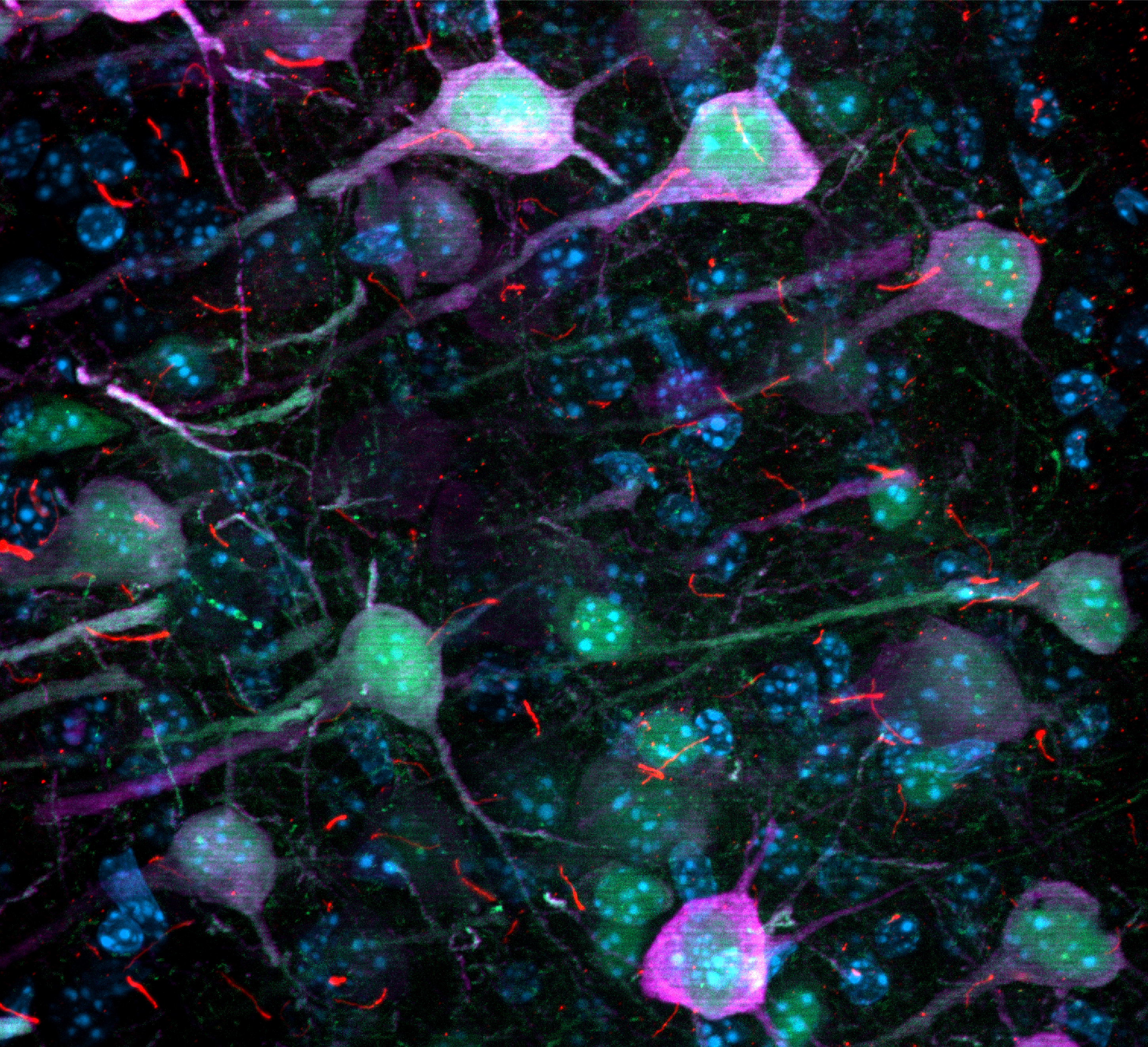Multi-channel fluorescence microscopy of neurons with primary cilia